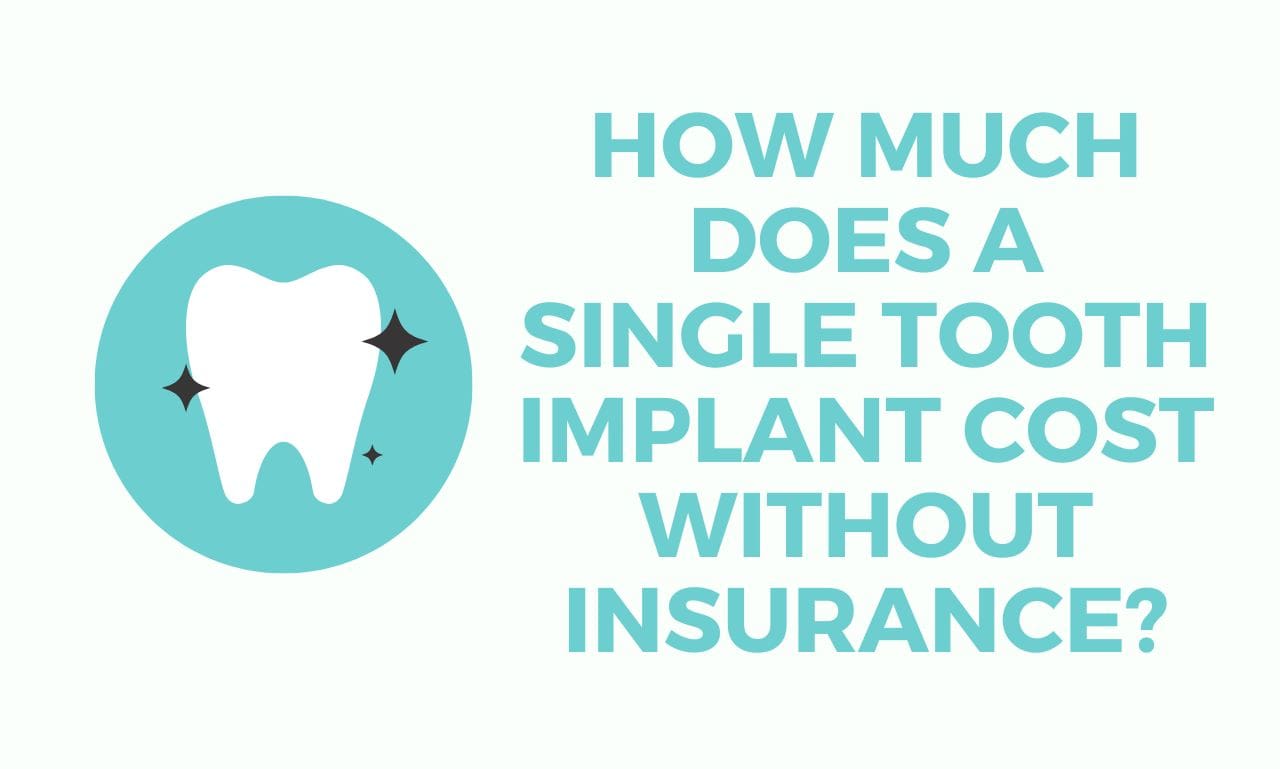 How Much Does a Single Tooth Implant Cost Without Insurance
